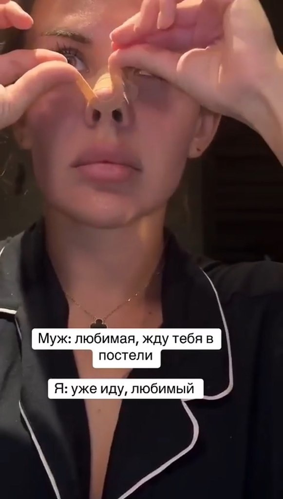     ? - 2