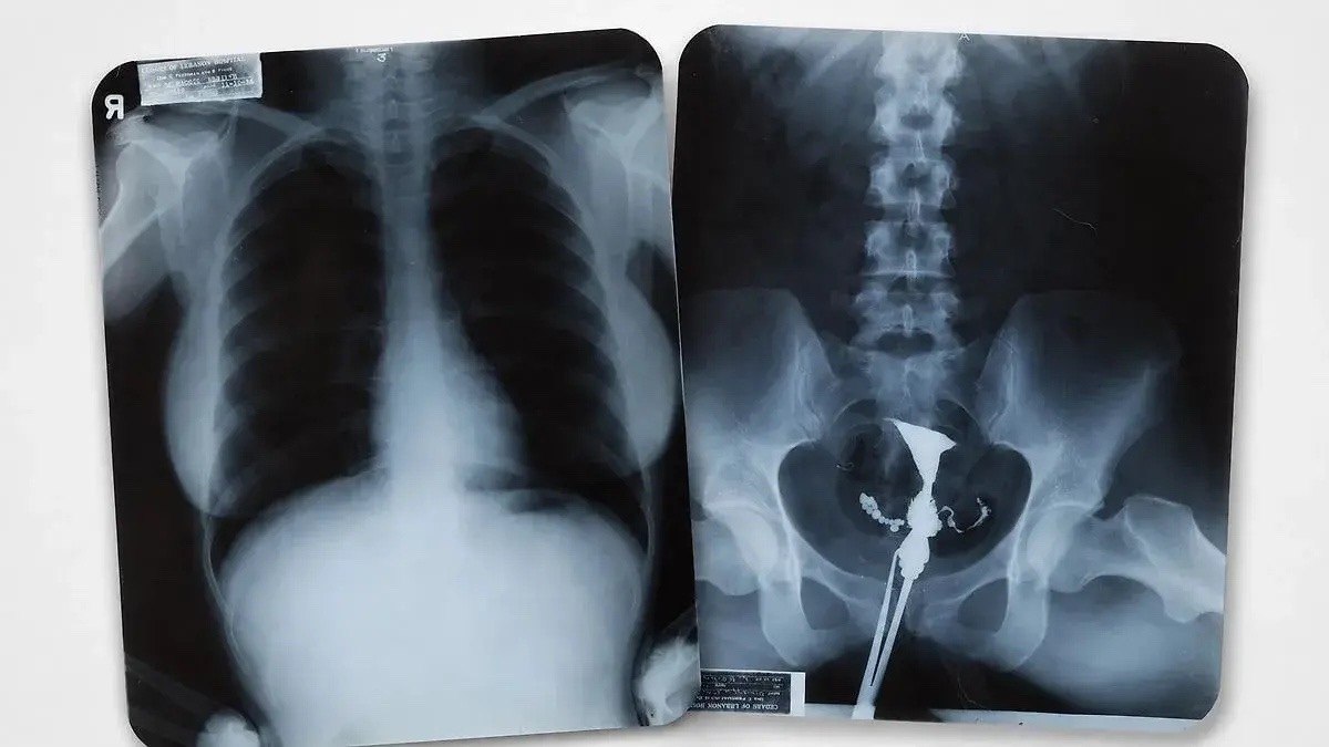 � 100����� ������� ����� ���������� ��� �������� �� ������� � ������������� ������ 1950�������, � ... - 2
