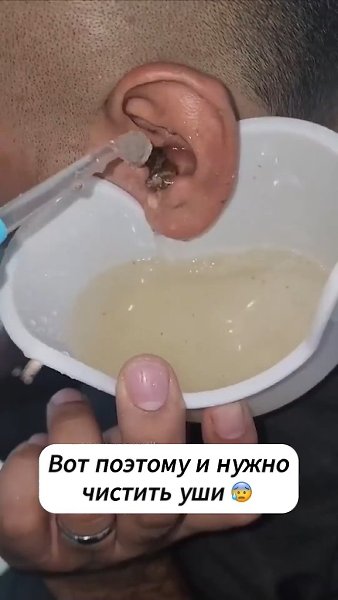         - 2