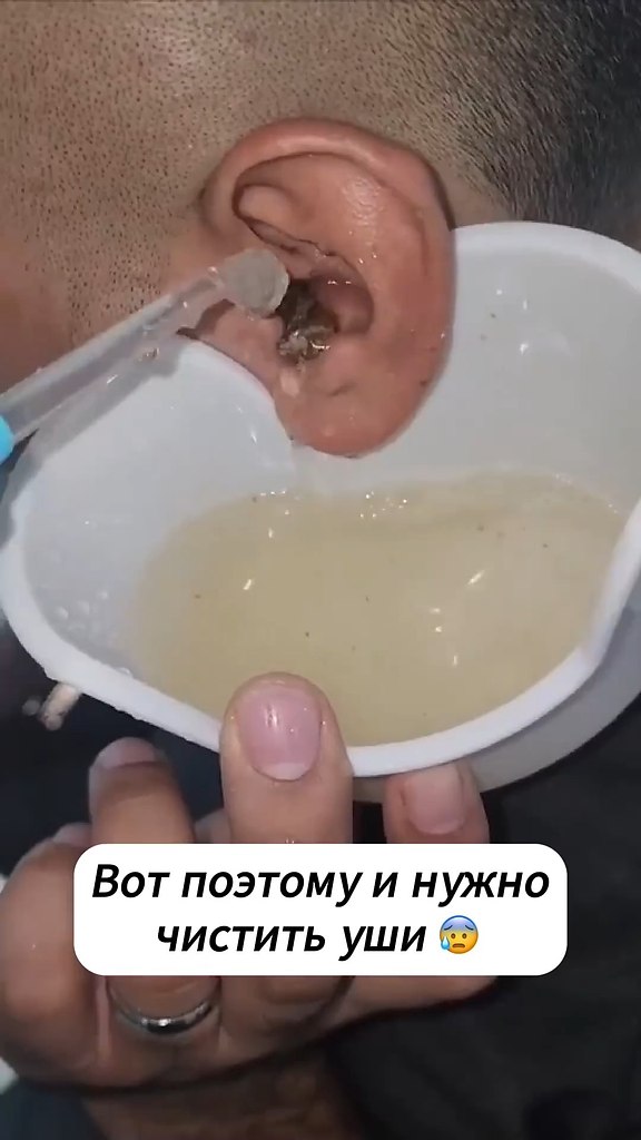         - 2