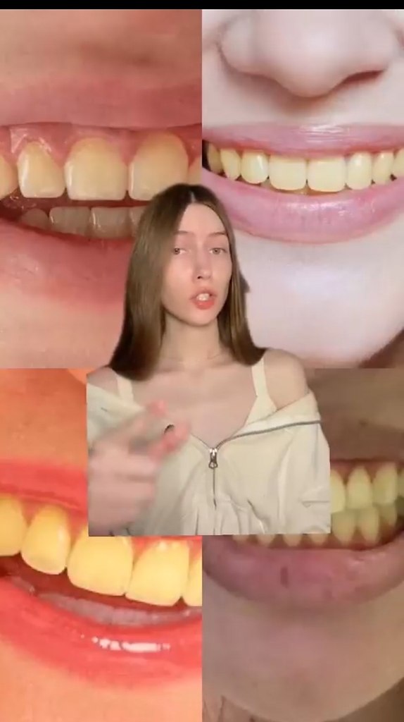         - 2