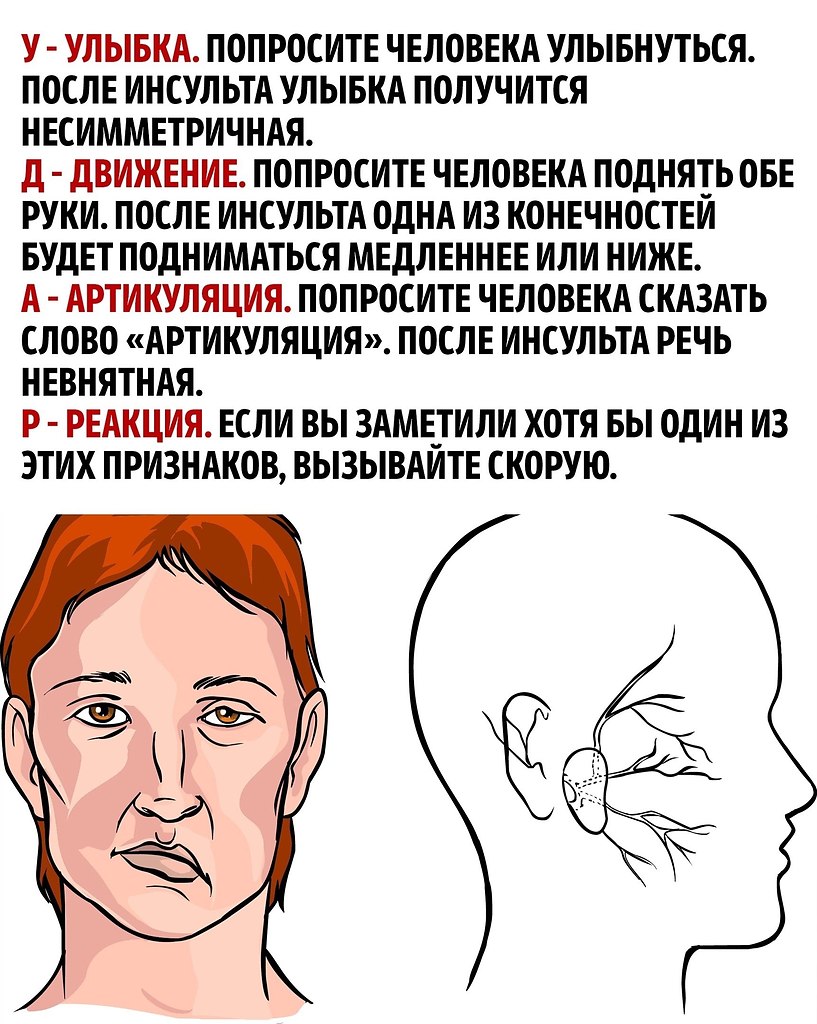   -    - 2