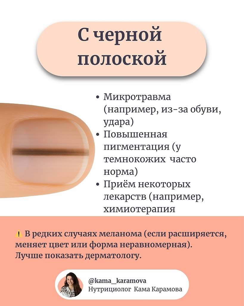  - 25  2025  17:42 - 5