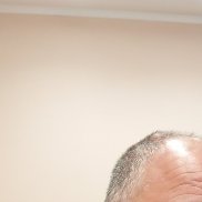 �������, 35 ���, ������