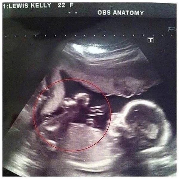 ���� ������ ��� ��� ������ ������� �� 17 ������ ������������, ����� �������, ��� �� ������, ...