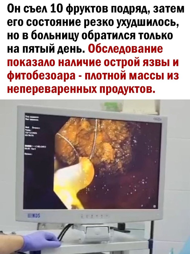 � ����� ������ - 2